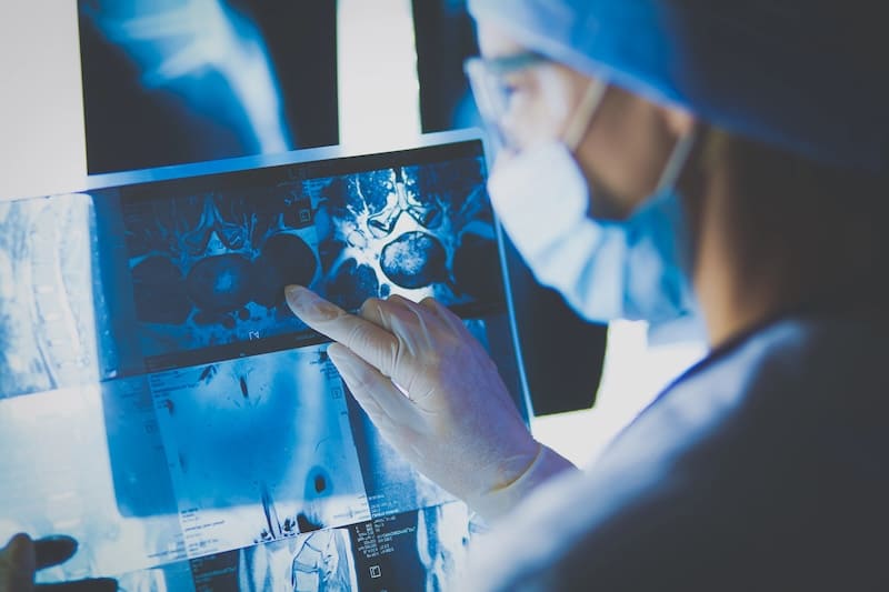 Rare Cancer and Sarcoma